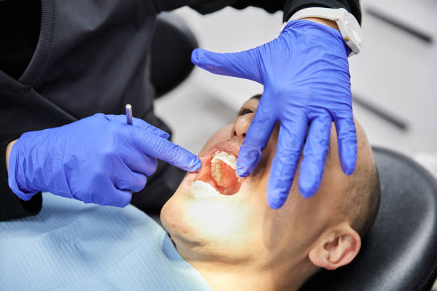 Best Dentist for Dental Trauma  in Freeburg, IL